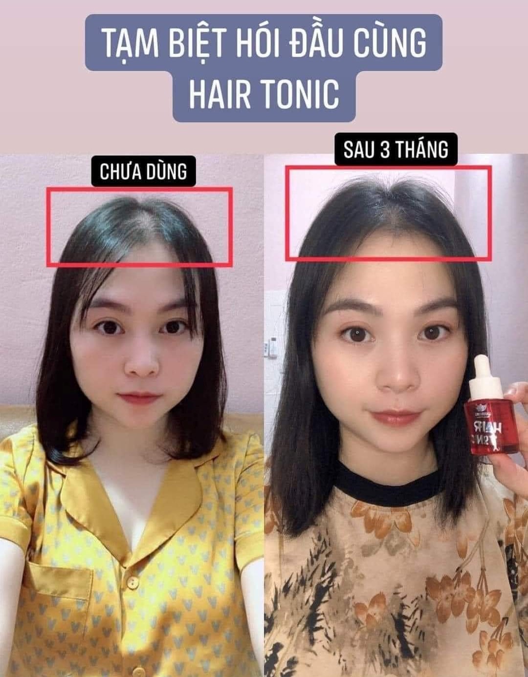 Tinh Chất Đặc trị hói đầu, bạc tóc, rụng tóc, kích thích mọc tóc, mi - Hair Tonic Linh Hương