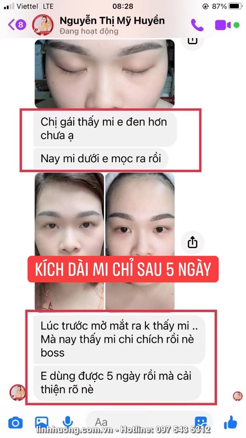 Tinh Chất Đặc trị hói đầu, bạc tóc, rụng tóc, kích thích mọc tóc, mi - Hair Tonic